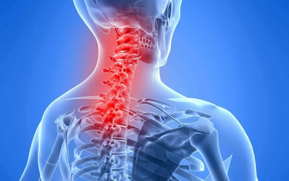 Cholelithiasis, Cervical Pain And Hypertension
